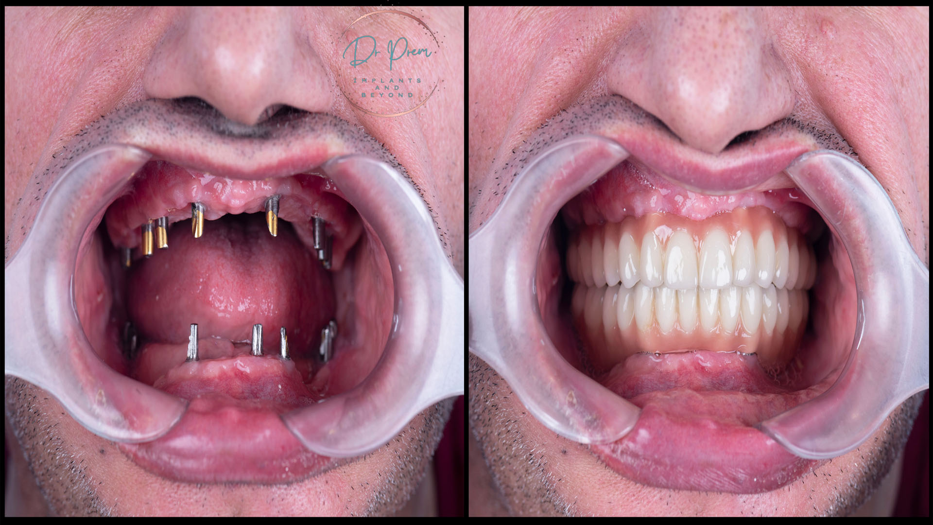 Unveiling Dental Excellence at Doctorprem Dental Hospital